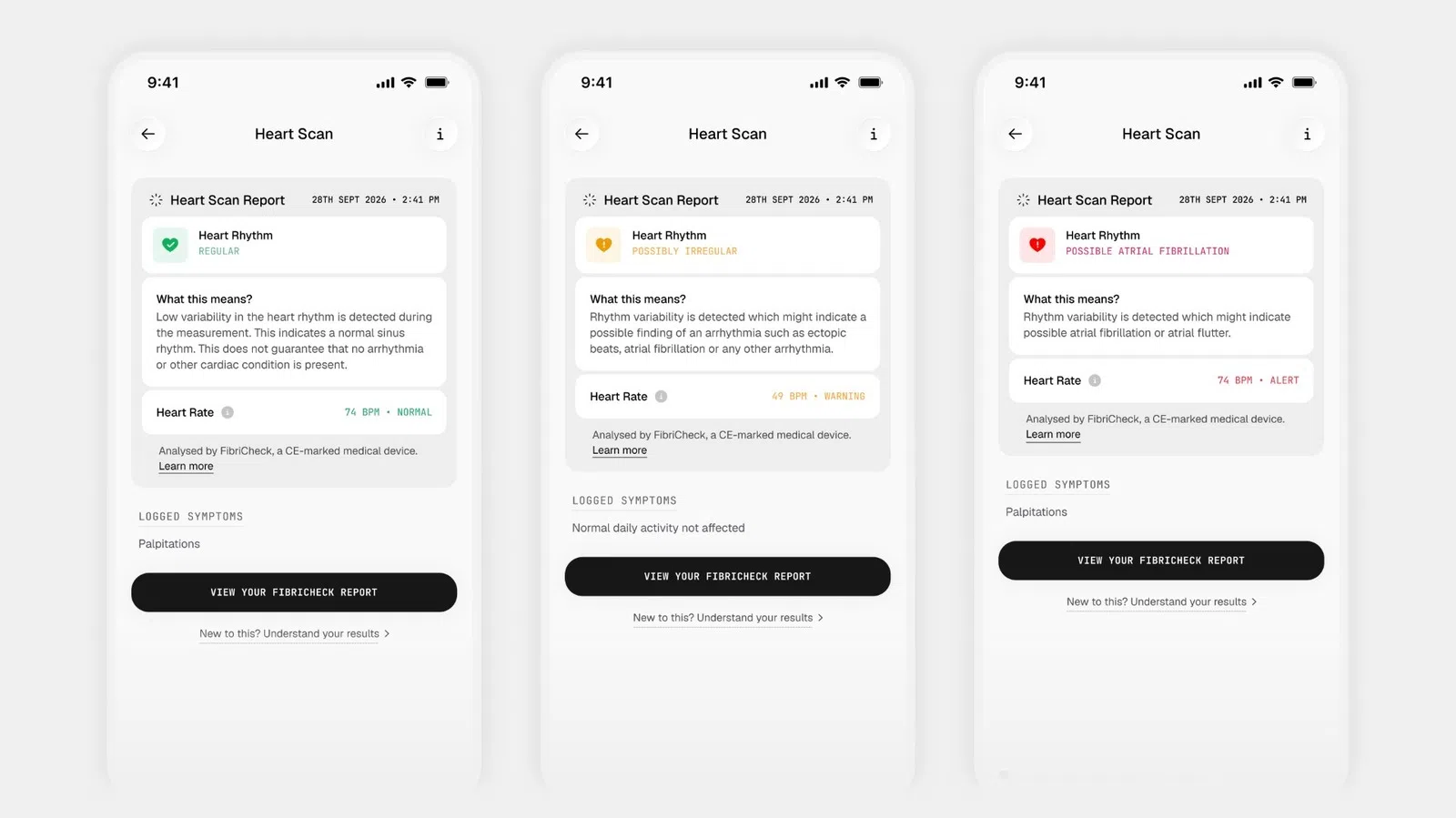 Ultrahuman lancia la scansione del ritmo cardiaco on-demand
